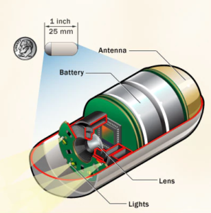capsule-endoscopy-kakinada