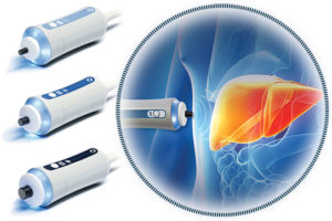 fibro-scan-trust-hospitals-kakinada